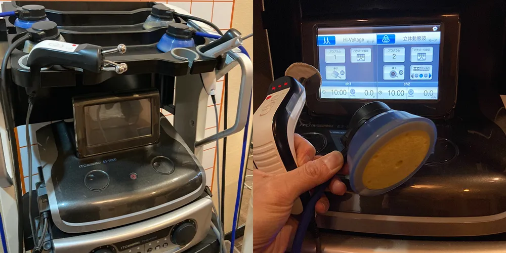 超音波治療の機械